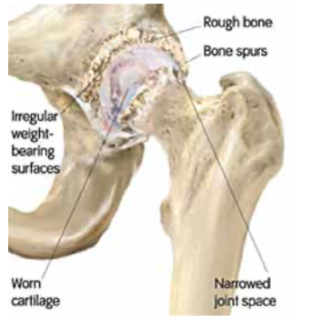 Problem Hip